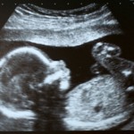 The Pro-Choice Anthem: It Was Right For Me and No One Else
